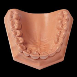 Snap-Stone Labstone Type IV High Strength Pink 5kg