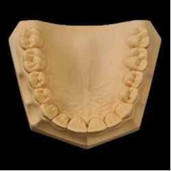 UltiRock Die Stone Type IV Golden Brown 22kg