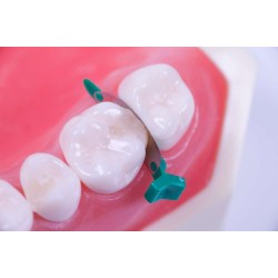 FenderMate Green, Left Regular