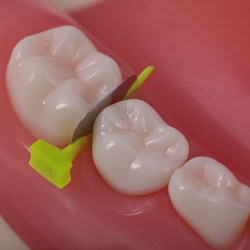 FenderMate Prime Assortment, 2 x18pcs