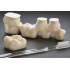 MODEL - POSTERIOR GIANT MODEL, SET OF 8 TEETH