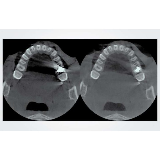 Durray 2D CEPH Extraoral Xray