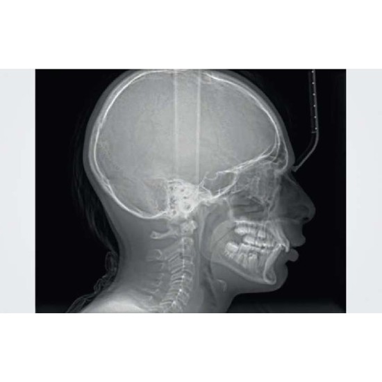 Durray 2D CEPH Extraoral Xray