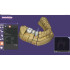 exocad DentalCAD