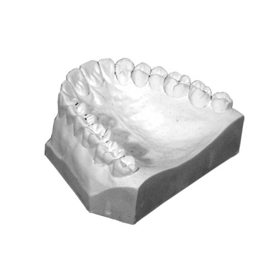 Implant Scanning Stone Charcol Type IV 25Lbs